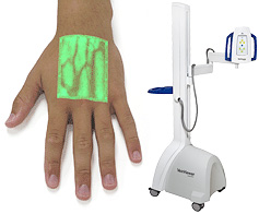 Luminetx VeinViewer (Image courtesy Luminetx Technologies)