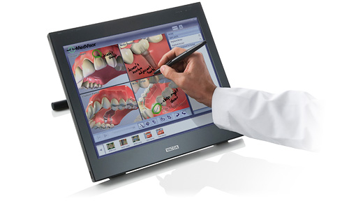 Wacom DTF-521 Pen Based Display (Image courtesy Wacom)