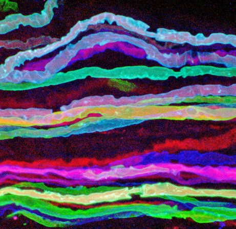 Brainbows
