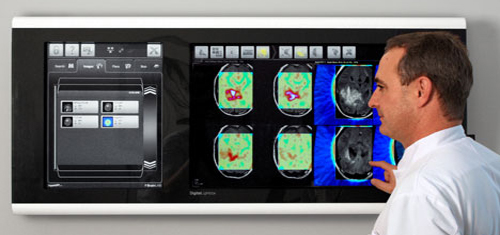 Giant iPhone For X-Rays from Digital Lightbox