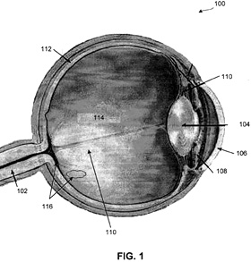 Human Eyeball Cross-Section (Image courtesy WIPO)