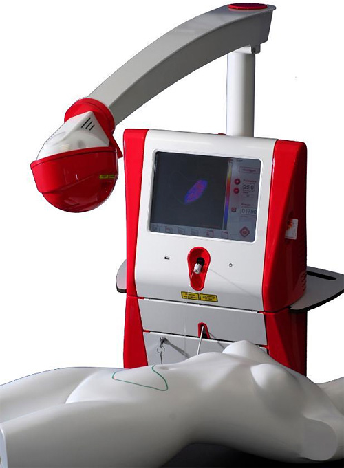 lipocontrol LipoControl Laser Fat Removal System (Image courtesy Osyris Medical)