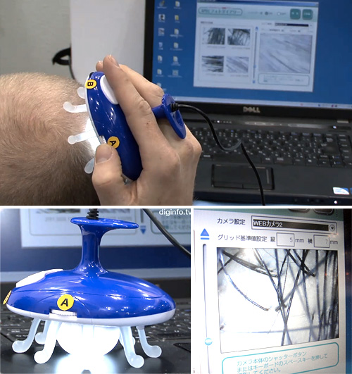 Scaloupe Scalp Camera (Images courtesy DigInfo TV)