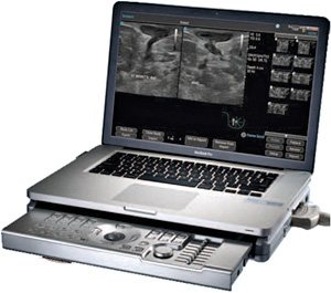 Terason t3200 Ultrasound System Breast Series (Image courtesy Terason)
