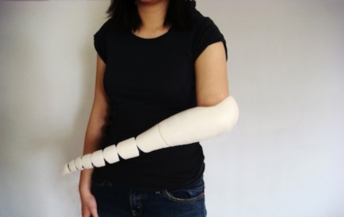Tentacle-Prosthesis